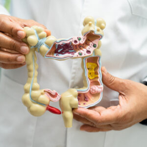 Intestine, appendix and digestive system, doctor holding anatomy model.